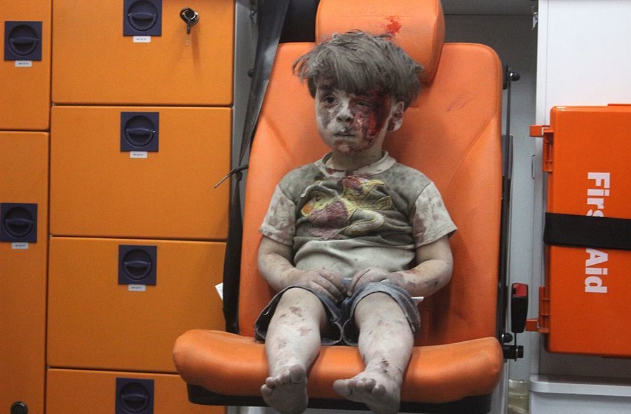 Bloodied Syrian Boy